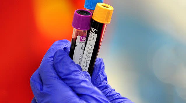 The blood test could end up saving up to 7,500 live each year in Australia. Source: AAP