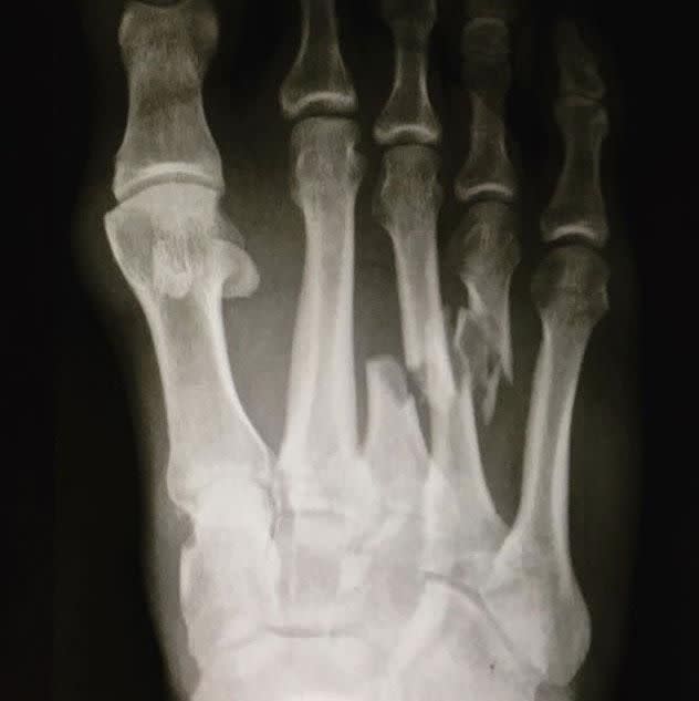 Slater's X-ray. Pic: Instagram