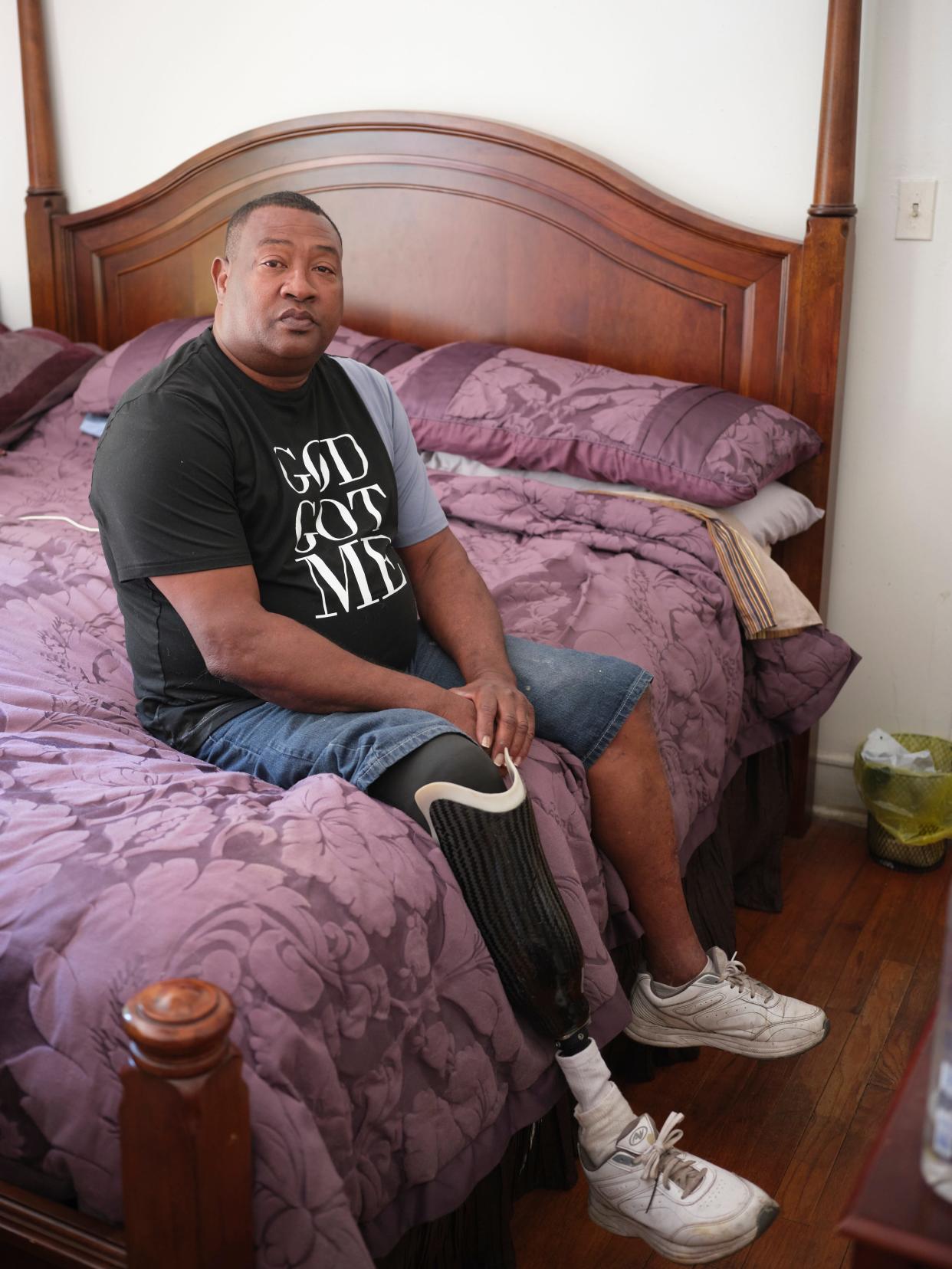 “It’s a totally different life, “ James Haynes said after losing his foot. He can’t work on cars anymore, something he loved to do. “If I can’t get help I need to train myself. If this is my life now, I need to accept it.”