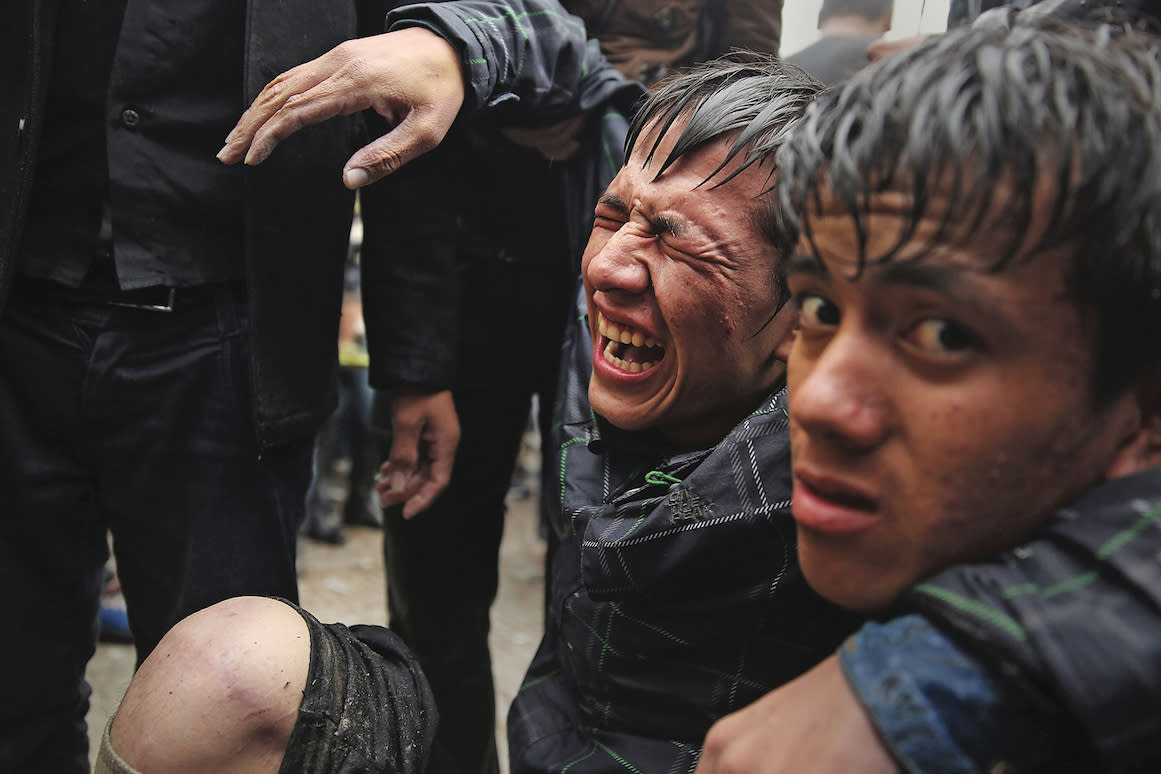 MYTILENE, GREECE - OCTOBER 22:  An Afghan man injured in fighting is helped as violence escalates for migrants waiting to be processed at the increasingly overwhelmed Moria camp on the island of Lesbos on October 22, 2015 in Mytilene, Greece. Dozens of rafts and boats are still making the journey daily as thousands flee conflict in Iraq, Syria, Afghanistan and other countries. More than 500,000 migrants have entered Europe so far this year. Of that number, four-fifths have paid to be smuggled by sea to Greece from Turkey, the main transit route into the EU. Nearly all of those entering Greece on a boat from Turkey are from the war zones of Syria, Iraq and Afghanistan.  (Photo by Spencer Platt/Getty Images)