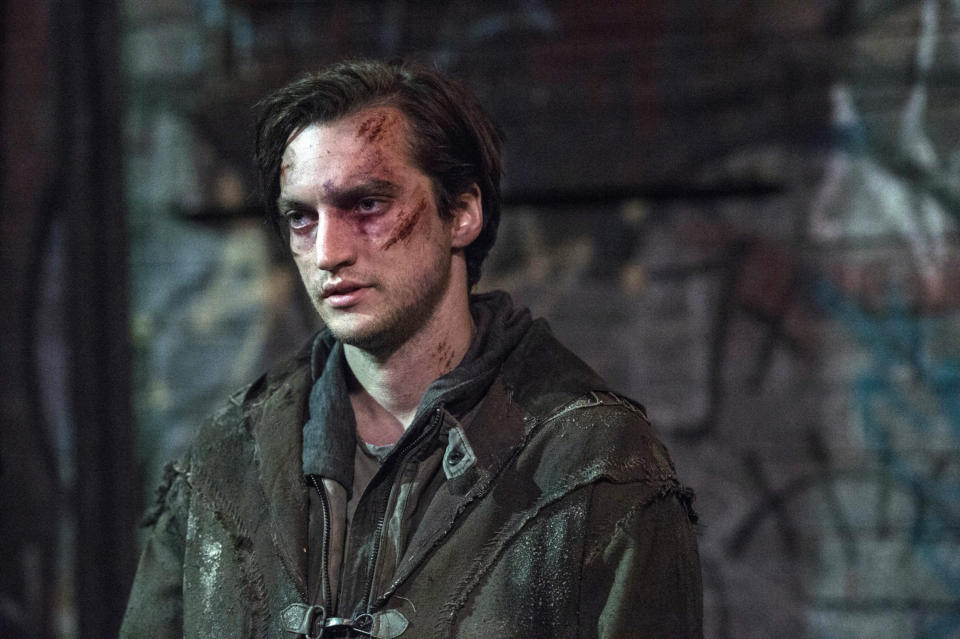 Man with bruises and dirt on his face, dressed in a worn-out jacket, looks distressed