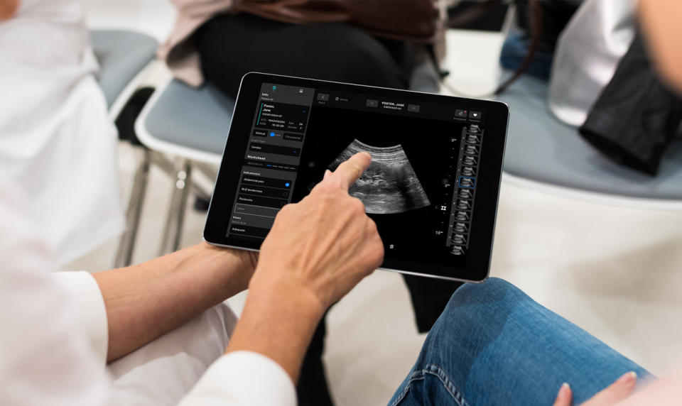 A medical staff member points to a sonogram on a laptop screen.