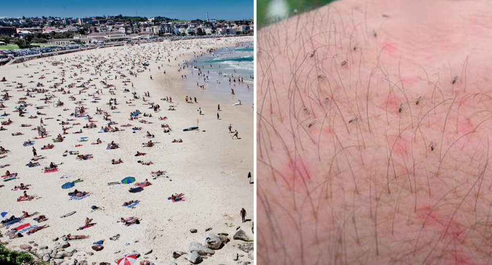 Left, an image of the people on Bondi beach. Right, tiny sand flies on a man's body, appearing as small specs against the skin irritated skin. 