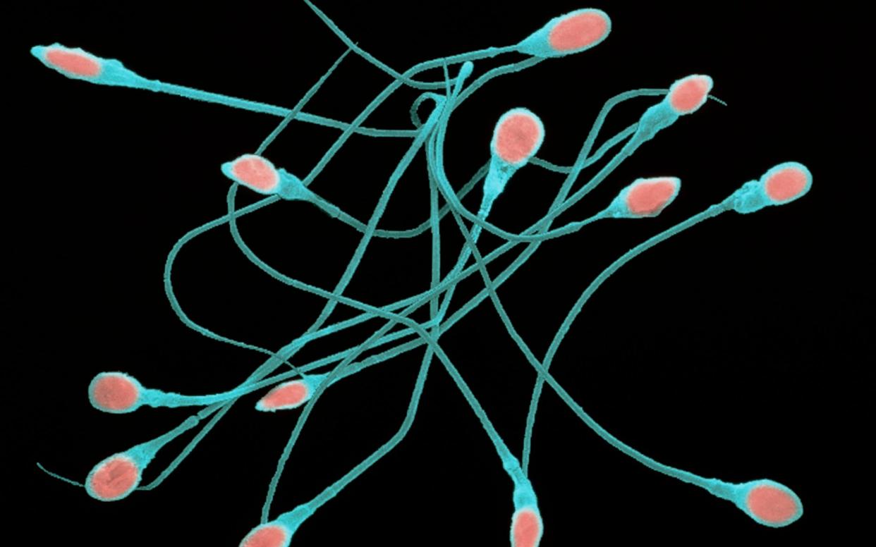Coloured SEM of Human Sperm  - DR TONY BRAIN/SCIENCE PHOTO LIBRARY 