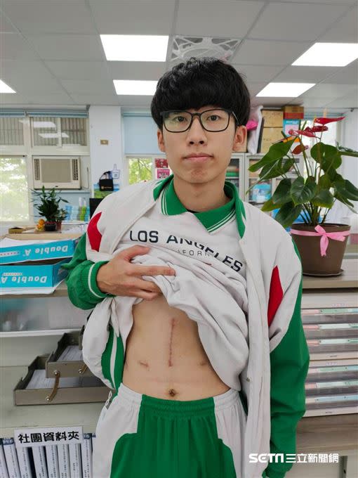 高中生楊澐坤捐出50%肝臟救父，他表示和養育之恩相比，手術的皮肉之痛不算甚麼。（圖／泰北高中提供）
