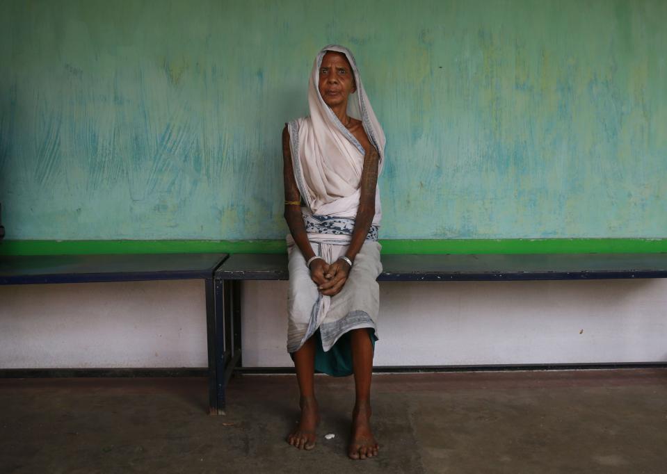 In this April 15, 2014 photo, a woman who lives near an open coal mine, and suffering breathing problem waits at Dr. Harihar Patel's home clinic at Gare village near the industrial city of Raigarh, Chhattisgarh state, India. Patel, the area’s only trained doctor for 10 kilometers (six miles), said he's seen an enormous leap in the number of people with asthma and other lung ailments, skin lesions and exhaustion. (AP Photo/Rafiq Maqbool)