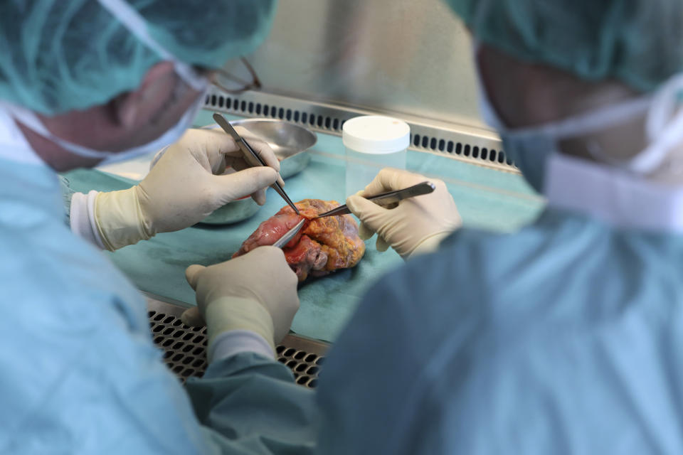 Physicians work on a heart of a dead person at an organ bank in Rostock, Germany, May 23, 2017. (Bernd Wüstneck/dpa via AP)