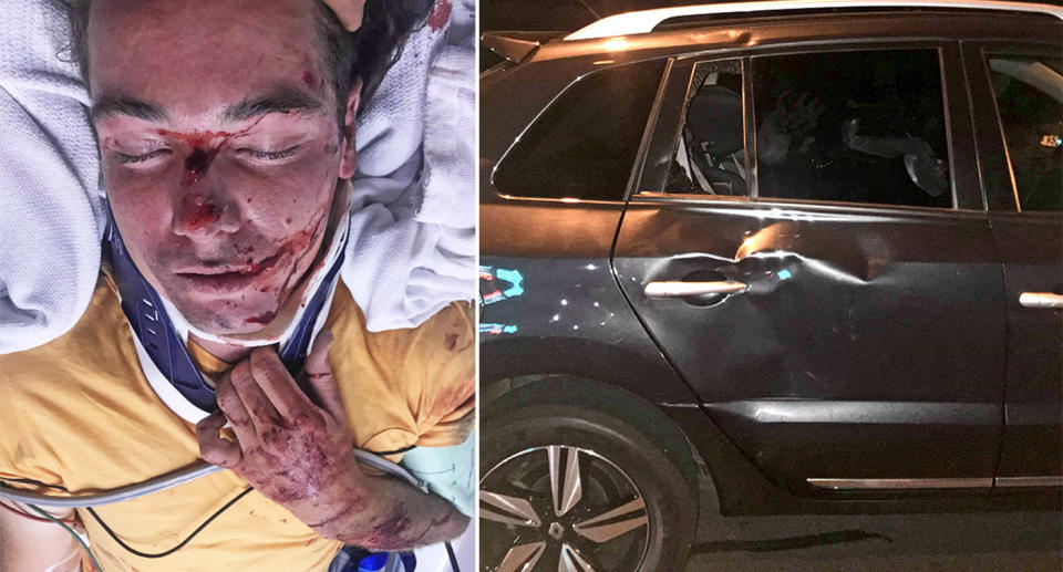 Cooper Oldfield lies in hospital after his skateboarding accident in Launceston, while a photo of the car involved shows a large dent in the back door.