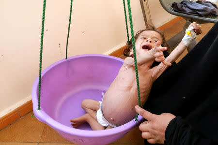 FILE PHOTO: Malnourished Zakaria Yahya (21 months) is weighed in a hospital in the northwestern city of Saada, Yemen, November 21, 2018. Picture taken November 21, 2018. REUTERS/Naif Rahma/File Photo