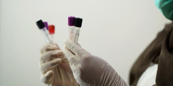 6 de cada 10 pruebas de coronavirus en Baja California dan positivo