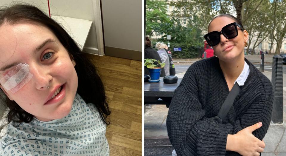 Two pics of Caoimhe Reddy in a hospital gown and out in public with sunglasses on, her paralysed face visible.  (SWNS)