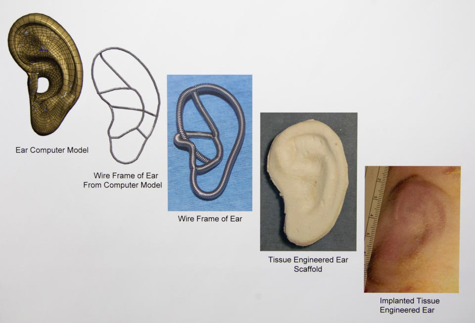 In this July 2, 2012 copy photo a chart provided by the Laboratory for Tissue Engineering and Organ Fabrication at Massachusetts General Hospital, depicts the progression, from left to right, of implanted tissue engineered for ear development and construction, at the lab in Boston. Scientists are growing ears, bone and skin in the lab, and doctors are planning more face transplants and other extreme plastic surgeries. Around the country, the most advanced medical tools that exist are now being deployed to help America's newest veterans and wounded troops. (AP Photo/Laboratory for Tissue Engineering and Organ Fabrication at Massachusetts General Hospital)