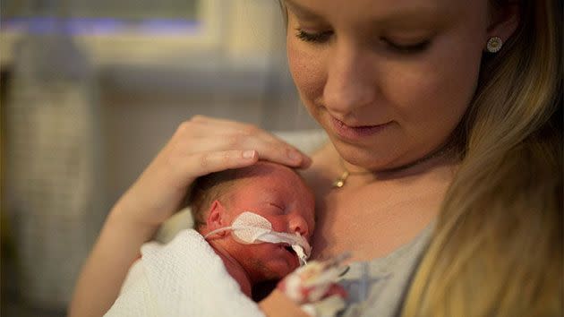 Isaac was born 10 weeks early in a UK hospital weighing just 1.5kg. Photo: Yahoo UK