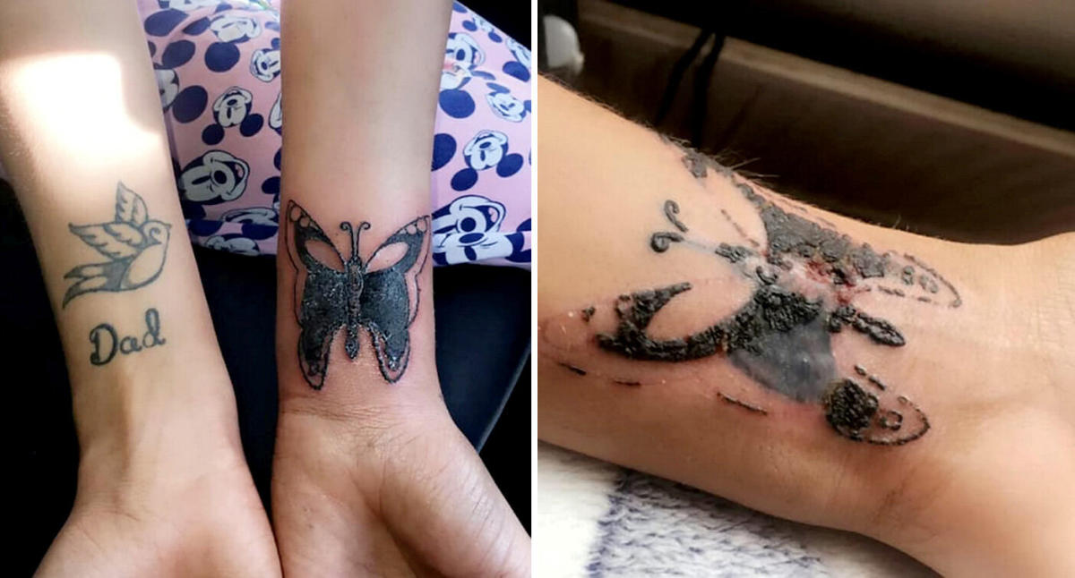 Signs and symptoms of tattoo infection and what to do about it