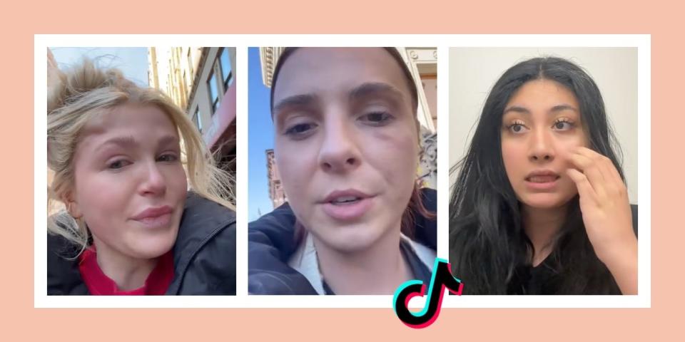 Women on TikTok describe getting punched in the face in NYC