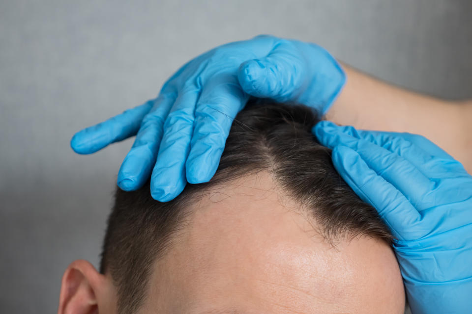 a doctor performs a check up of a man's thinning hair