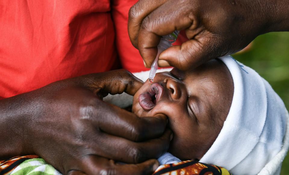 March 20, 2022: A baby receives a polio vaccine during the Malawi Polio Vaccination Campaign Launch in Lilongwe, Malawi. The World Health Organization said on Thursday, April 28, 2022 that Africa is seeing a surge of outbreaks of preventable diseases as a result of disruptions caused by the coronavirus pandemic.