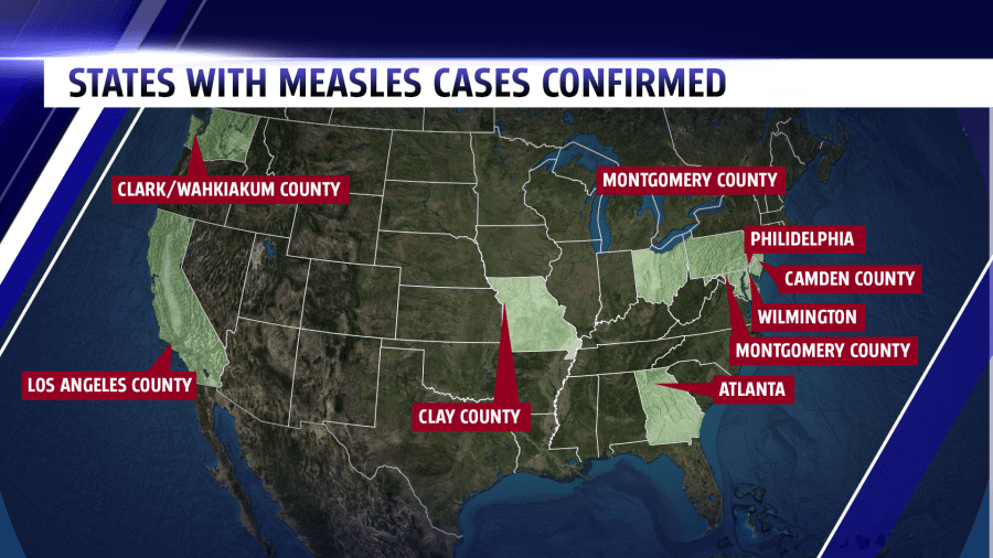 Measles cases in nine states now