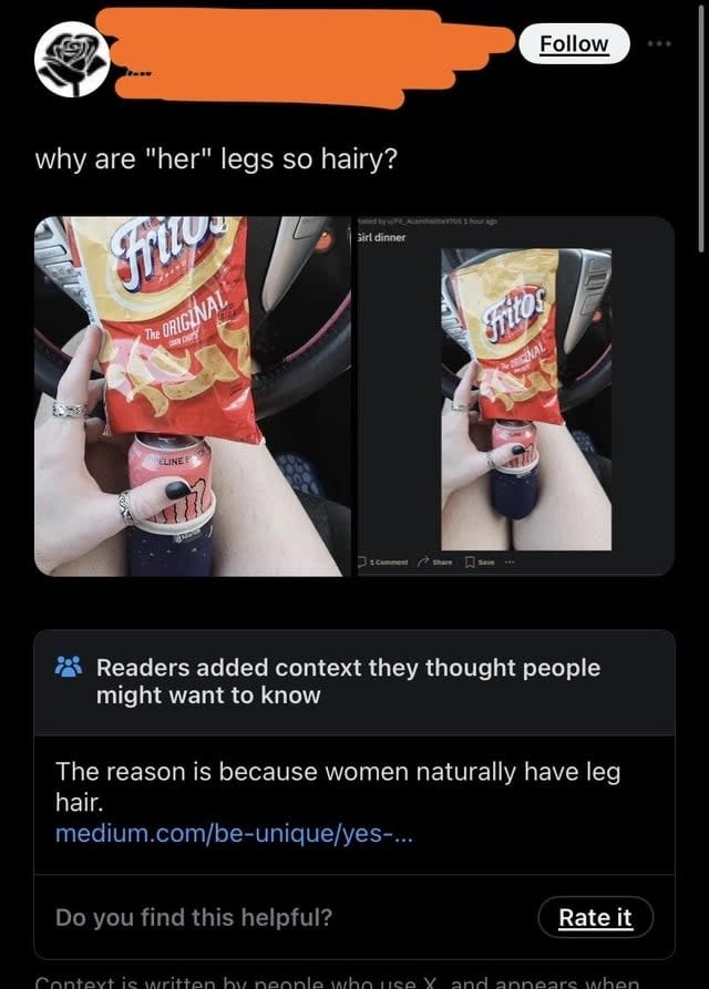 "The reason is because women naturally have leg hair."