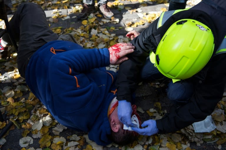 Fifteen police officers were among those injured during a demonstration in Girona earlier this month