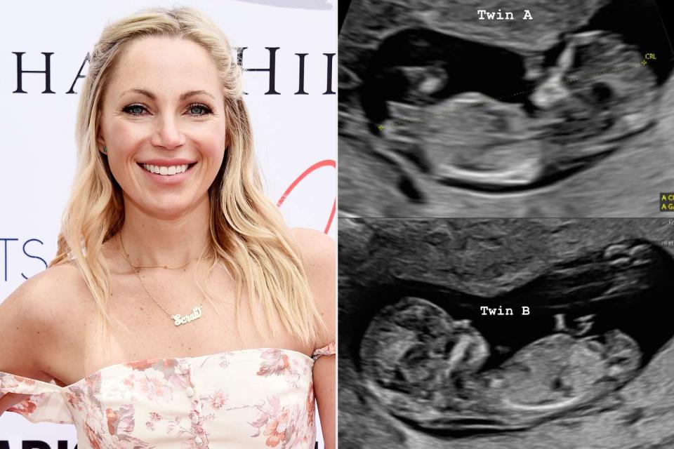 <p>Amanda Edwards/Getty; Sarah Herron/Instagram</p> Sarah Herron (L), Ultrasound of Sarah Herron