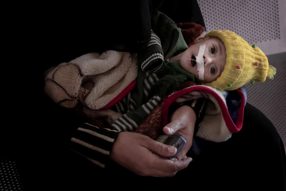 <p>Gawad Awad, a severely malnourished Yemeni 4-month-old, lies in the lap of his mother, Heba Ahmed, in the Al-Sadaqa Hospital in Aden, Yemen, this Feb. 13, 2018 photo. Gawad weighed 2.5 kg (5.5 pounds). Adenâs hospital is the best supplied in southern Yemen, but many of the other hospitals around the south are short of supplies and under staff, and families with starving children canât afford to make the trip to Aden. (Photo: Nariman El-Mofty/AP) </p>