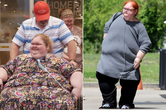 TLC, MEGA Tammy Slaton before and after her weight loss surgery