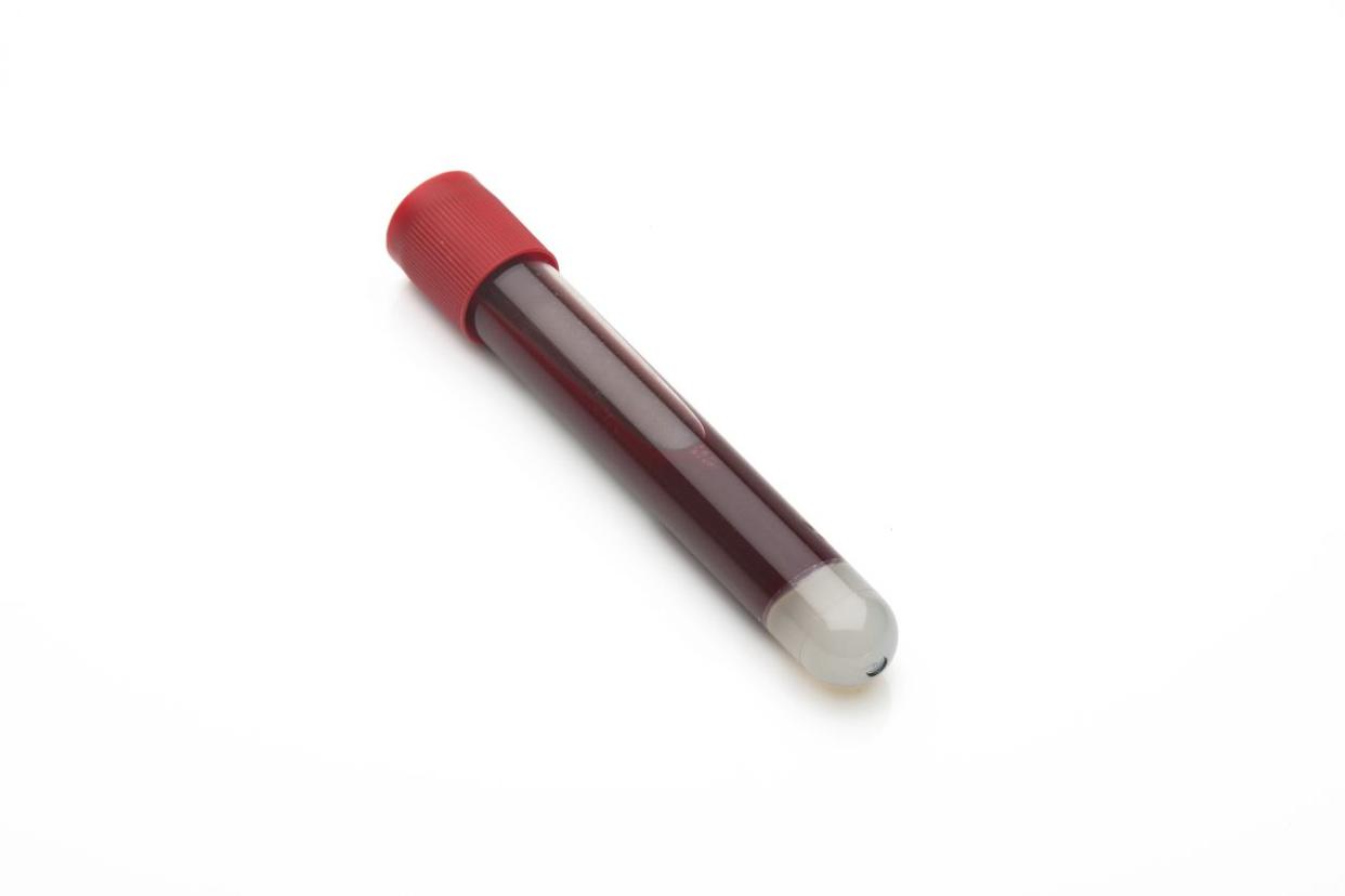 blood vial