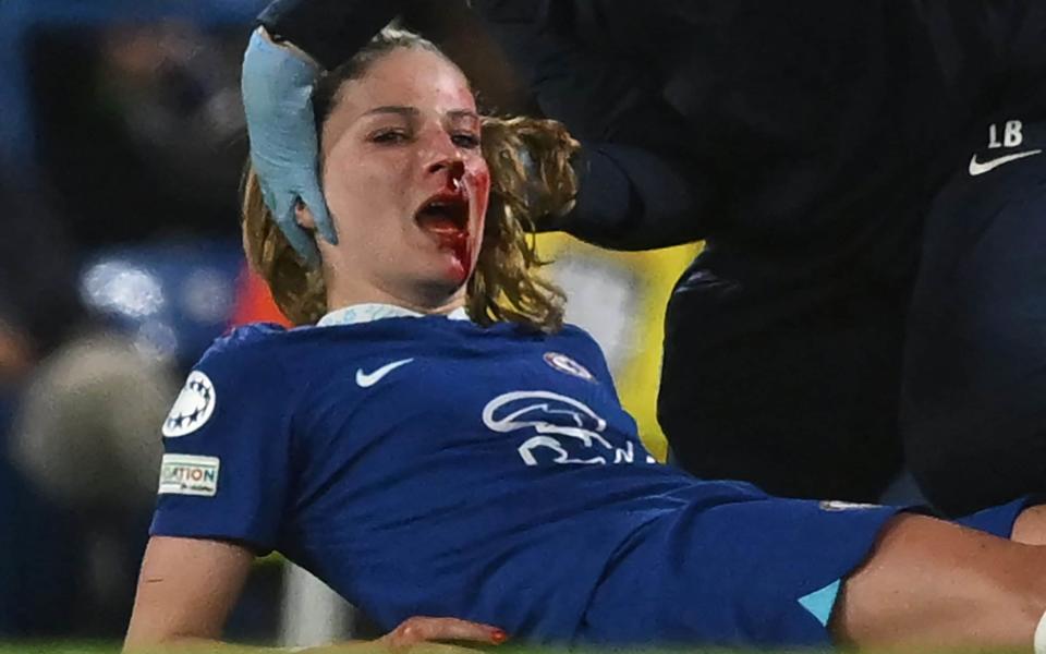 Chelsea's German midfielder Melanie Leupolz is treated by medical staff after being hurt in a collision - Getty Images/Justin Tallis
