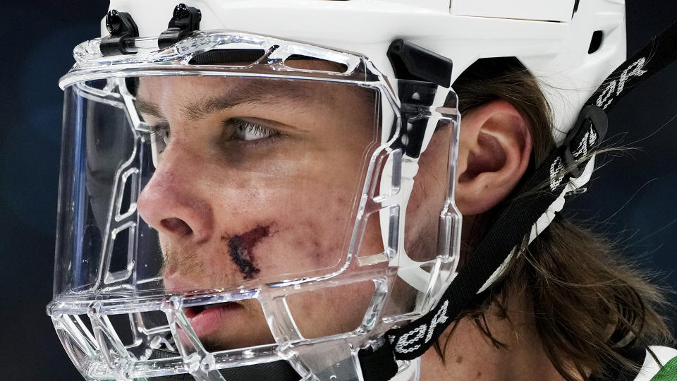 Dallas Stars defenseman Miro Heiskanen wears a face shield to protect stitches he received after being hit on the face by the puck in Game 3. (AP Photo/Lindsey Wasson)