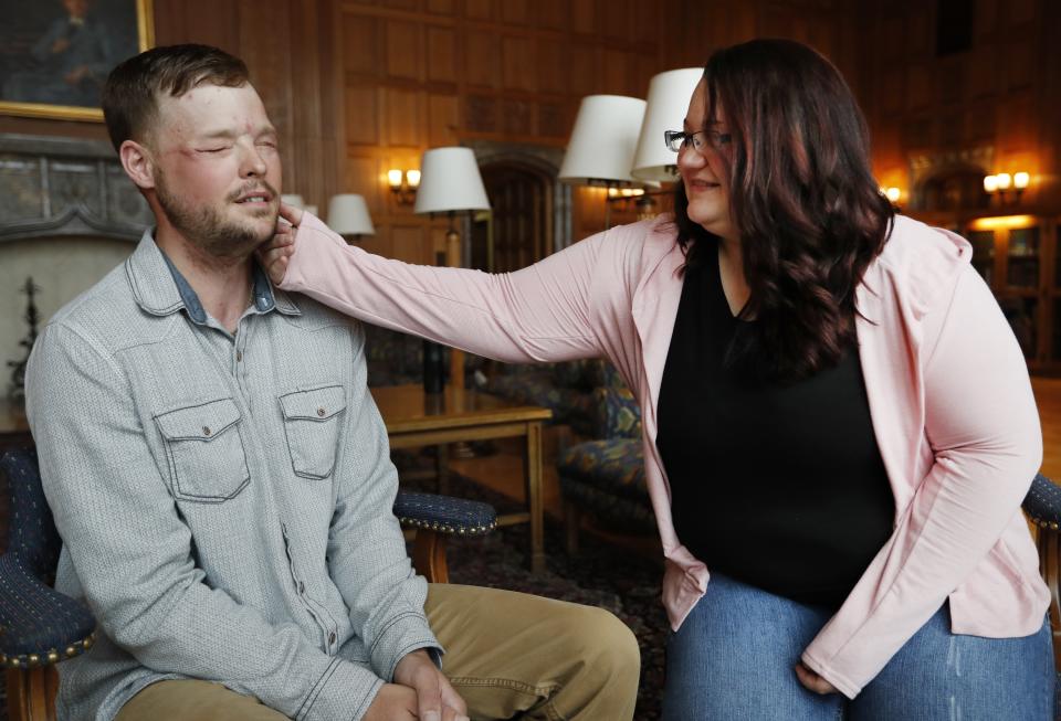 <em>Emotional – Lilly met the man who took on her late husband’s face for the first time (Pictures: Associated Press)</em>