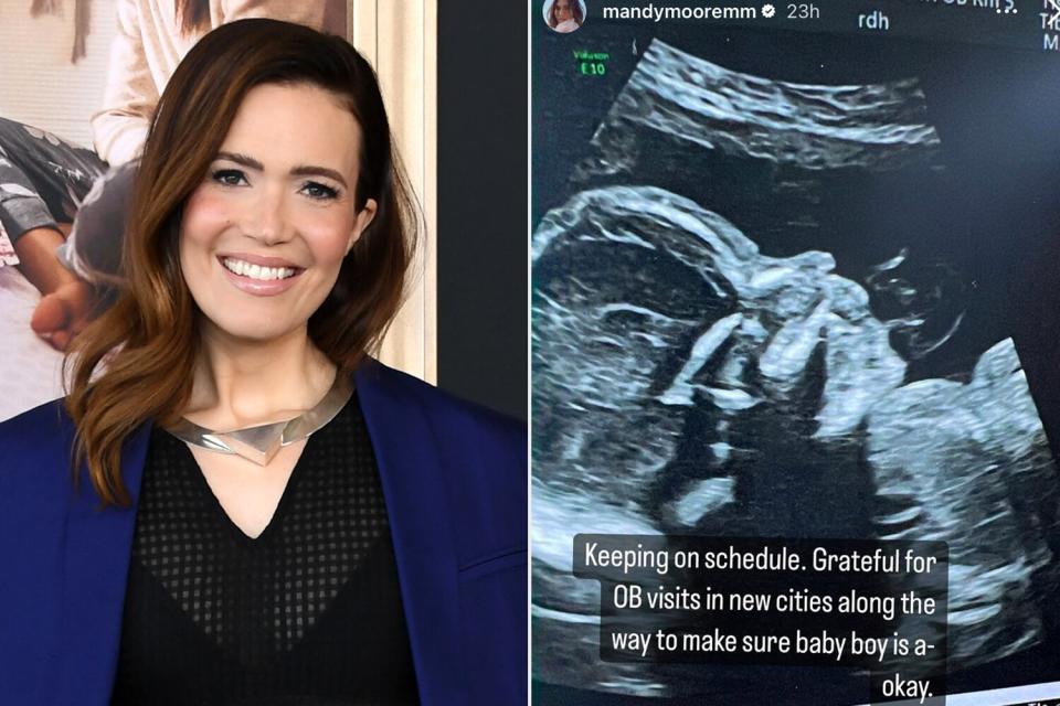 mandy moore, sonogram photo of mandy moore's baby