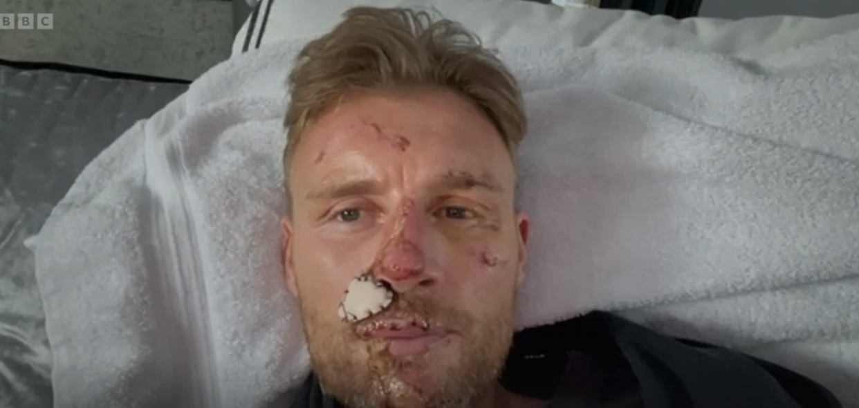 Freddie Flintoff spoke about his crash in Field of Dreams On Tour. (BBC screengrab)