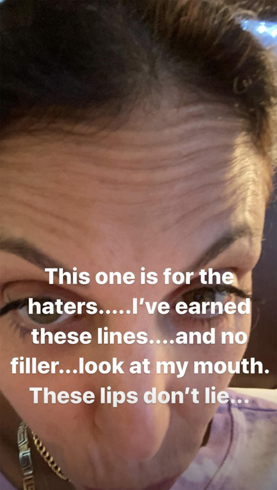 Frankel shared an unfiltered photo in her Instagram story in response to 