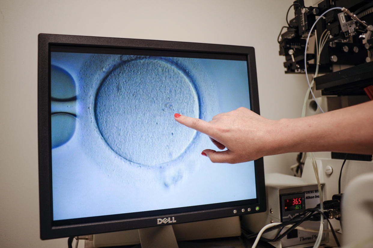 An embryologist shows an Ovocyte after it was inseminated at the Virginia Center for Reproductive Medicine, in Reston, Virginia. (Photo by Ivan Couronne / AFP) 