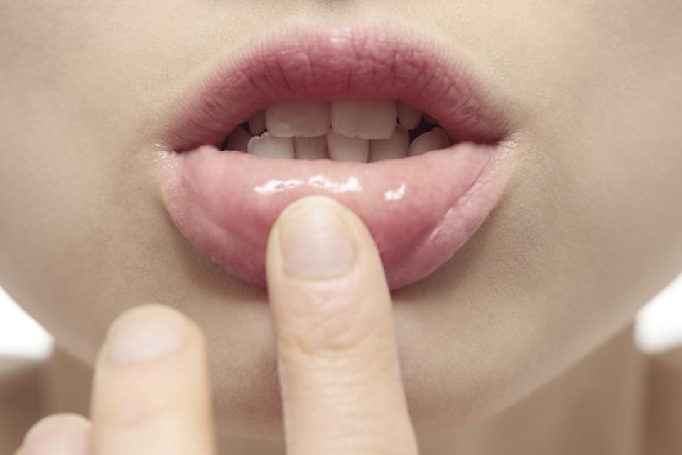 <p>Schiefe Zähne gelten in Japan als süß – Männer und Frauen lassen sich sogar Zähne vom Zahnarzt „richten“, um dem Schönheitsideal zu entsprechen. (Bild: Getty Images) </p>