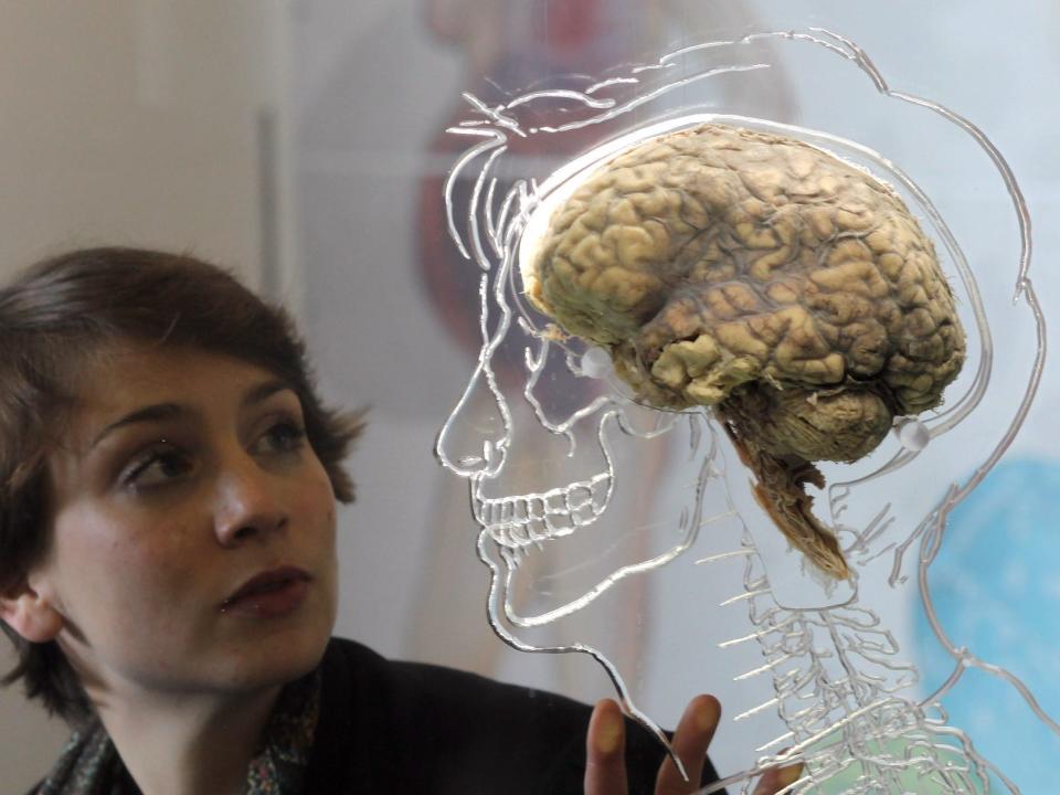 Nicole Briggs looks at a real human brain being displayed as part of new exhibition at the @Bristol attraction on March 8, 2011 in Bristol, England. The Real Brain exhibit - which comes with full consent from a anonymous donor and needed full consent from the Human Tissue Authority - is suspended in a large tank engraved with a full scale skeleton on one side and a diagram of the central nervous system on the other and is a key feature of the All About Us exhibition opening this week