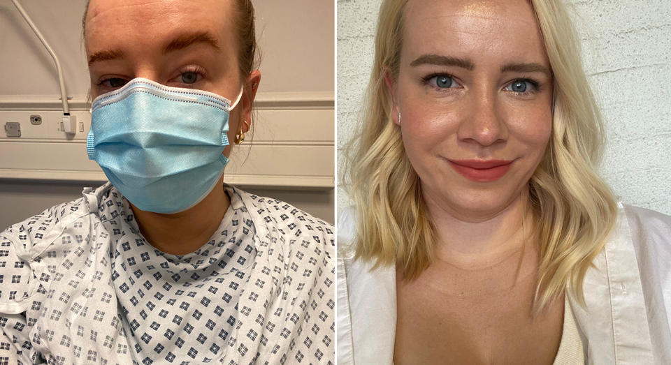 Orla Pentelow has been living with IBD since 2017. (Supplied)