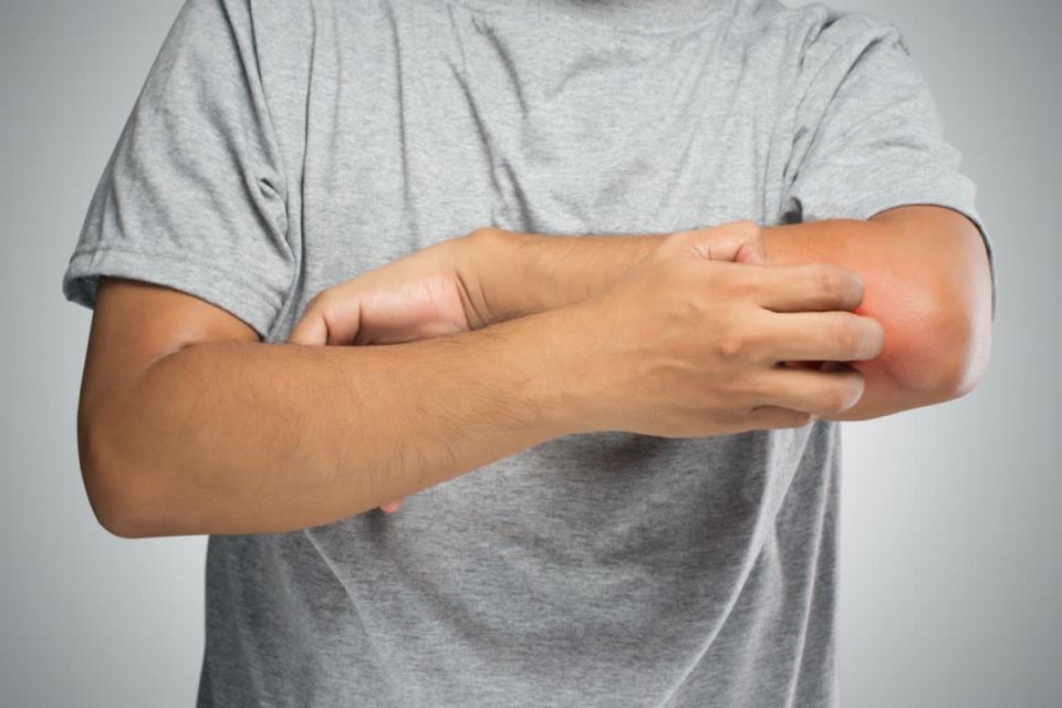 People scratch the itch with hand, Elbow