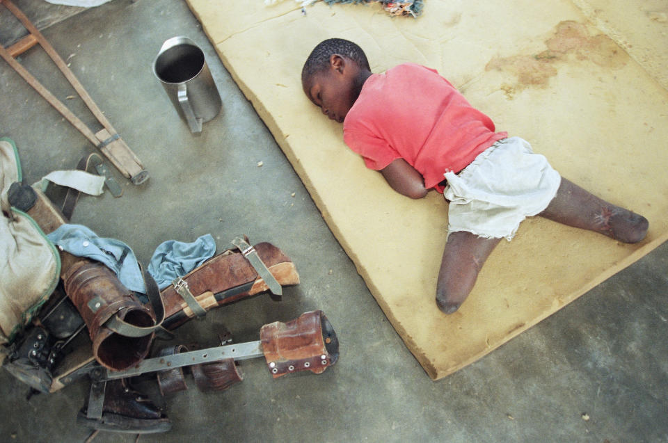 FILE - A young orphan, his legs amputated below the knee, rests on a foam cushion near his artificial limbs at an orphanage in Nyanza, about 35 miles southwest of the capital Kigali, Rwanda, June 9, 1994. (AP Photo/Jean-Marc Bouju, File)