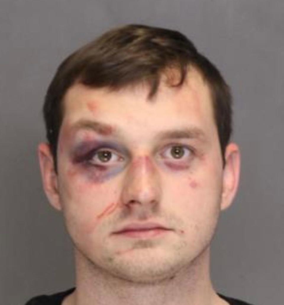 Brandon Higgs got beat up "pretty good" after allegedly shooting Elvis Smith, a prosecutor told jurors&nbsp;at the Circuit Court of Baltimore County on Monday. (Photo: Baltimore County Police Department )