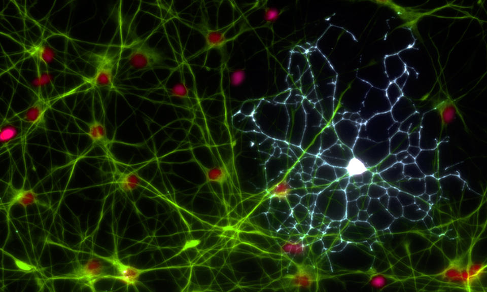 At first glance this may look like a spider’s web but this web measures just 1/20 of a millimeter. It is made up of two types of brain cells – astrocytes in green and a white oligodendrocyte. These cells were originally thought of as the support cells for neurons but it is now known they are essential for many brain functions.