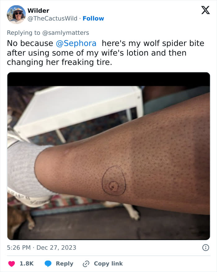 Screenshot of a tweet featuring a person's calf with a circled bite. The post's texts reads: 