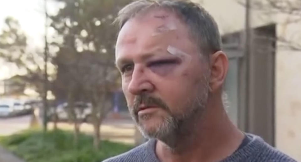 Perth dad Mark Cartledge claims he was bashed with a metal pole during a road rage attack in Perth. Source: 7 News