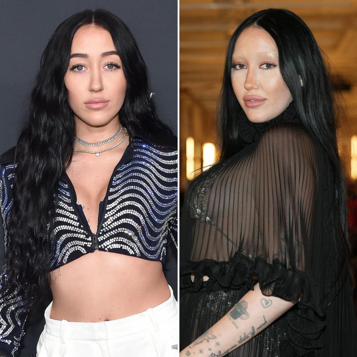 Did Noah Cyrus Ever Get Plastic Surgery? See Then and Now Photos of the  Singer