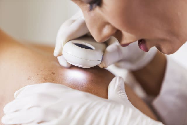 <p><br/></p><p>kali9</p> Stock photo of Dermatologist examining patient for signs of skin cancer