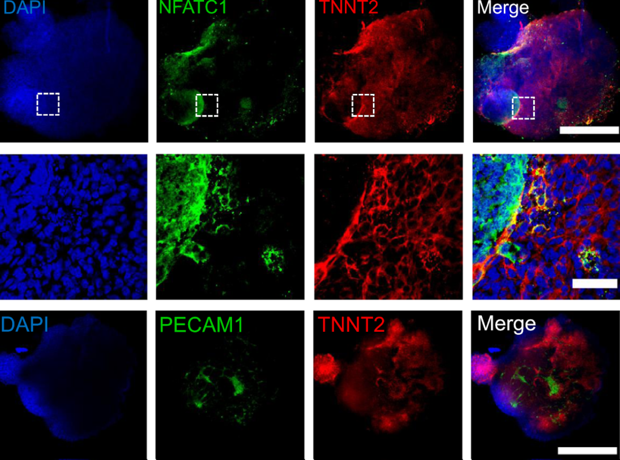 Organoids can replicate each component of the human heart, from its chambers to its veins. <a href="https://www.nature.com/articles/s41467-021-25329-5/figures/3" rel="nofollow noopener" target="_blank" data-ylk="slk:Yonatan R. Lewis-Israeli et al. 2021/Nature Communications;elm:context_link;itc:0;sec:content-canvas" class="link ">Yonatan R. Lewis-Israeli et al. 2021/Nature Communications</a>, <a href="http://creativecommons.org/licenses/by-sa/4.0/" rel="nofollow noopener" target="_blank" data-ylk="slk:CC BY-SA;elm:context_link;itc:0;sec:content-canvas" class="link ">CC BY-SA</a>