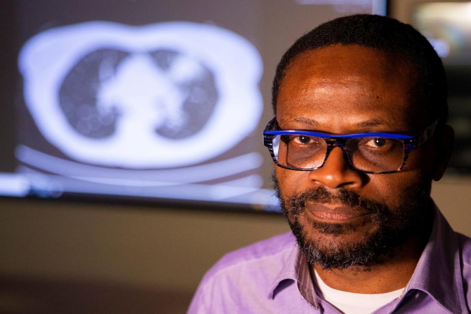 Dr. Raymond Osarogiagbon, a specialist in oncology and hematology at Baptist Cancer Center, poses for a portrait in the room where he and his team view scans for signs of cancer, like the one projected behind him, which shows lungs with a mass in the upper lobe of the left lung, in Memphis, Tenn., on Thursday, November 16, 2023.
