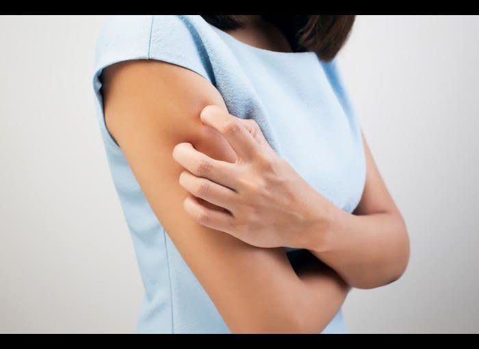 Itchy and dry skin is another common symptom of hypothyroidism. This has to do with skin turnover, Dr. Hall says. “It slows down which means there are older cells still on the skin.” You may <a href="http://www.theactivetimes.com/content/signs-you-need-more-iron-your-diet" target="_hplink">find your nails very breakable</a> all of a sudden. Insufficient thyroid hormone <a href="http://www.theactivetimes.com/fitness/n/10-widespread-myths-about-metabolism" target="_hplink">slows down metabolism</a>, which reduces sweating. The <a href="http://www.thyroid.ca/e9b.php" target="_hplink">dryness can be extreme</a>, this may cause  no sweating and the palms and soles to get thick and dry.    <em>Photo Credit: Shutterstock</a></em>  