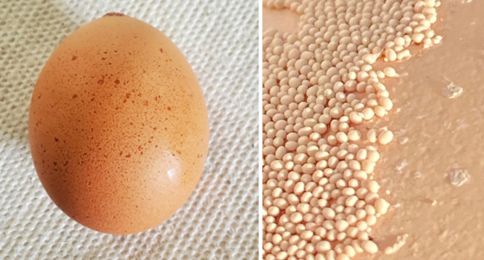 Speckled and lump chicken eggs with excess calcium. 
